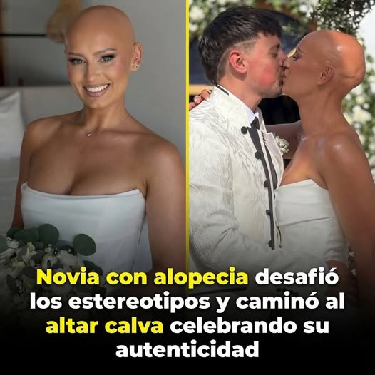 Novia con alopecia desafió todos los estereotipos y caminó al altar con la cabeza en alto